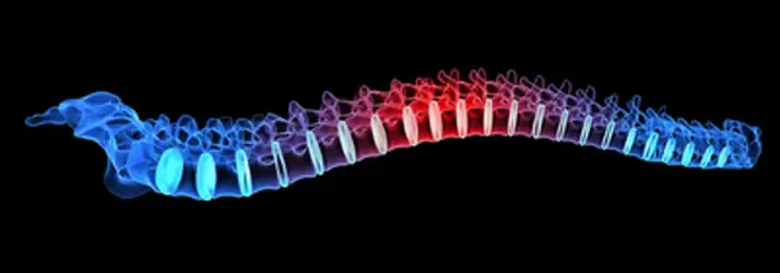 Digital rendering of a human spine with a gradient color scheme transitioning from blue to red, emphasizing spinal alignment and potential areas of tension.