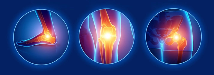 Three circular illustrations highlighting joint pain areas: ankle, knee, and hip, with glowing effects to indicate discomfort or inflammation.