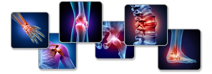 Digital illustration showing highlighted pain points in joints, spine, and bones on a dark backdrop.