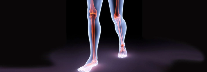 A digital illustration of human legs highlighting bones and joints.